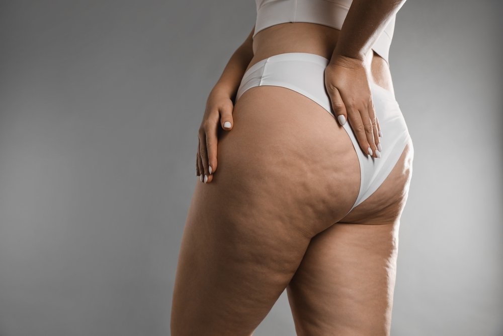 Lipedema Brasilia Magrass Asa Sul