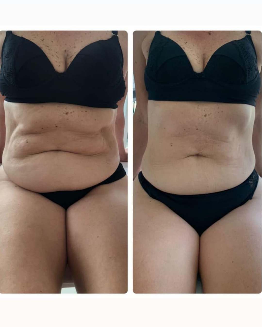 Emagrecimento Brasilia 02