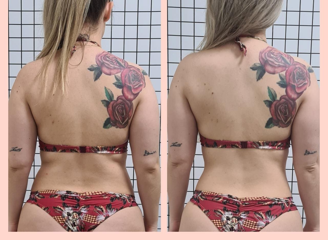 Emagrecimento Brasilia 03