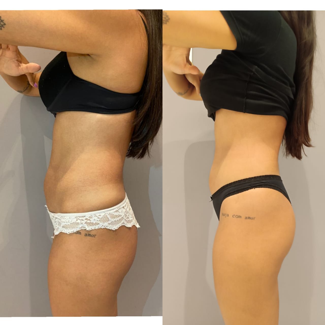 Emagrecimento brasilia 04