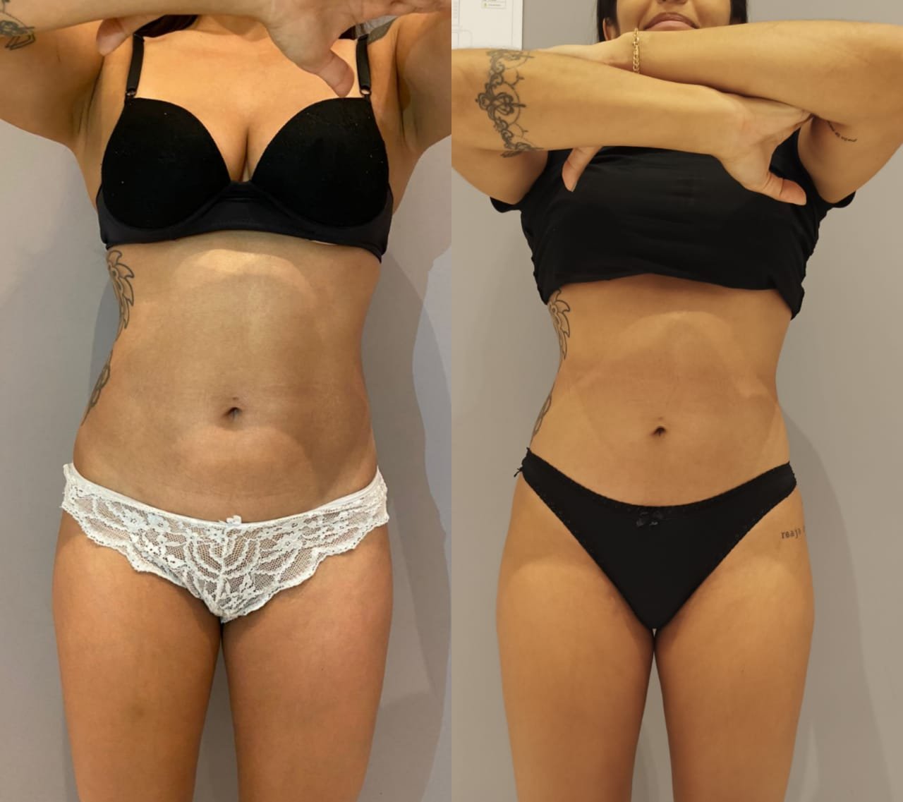 Emagrecimento brasilia 05